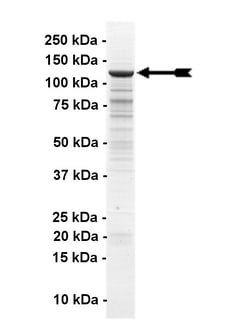 Eurofins DiscoverX Abl Human Protein, Active 10 &mu;g | Buy Online | Eurofins DiscoverX | Fisher Scientific